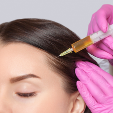 Person receiving a hair injection treatment with gloved hands holding a syringe.